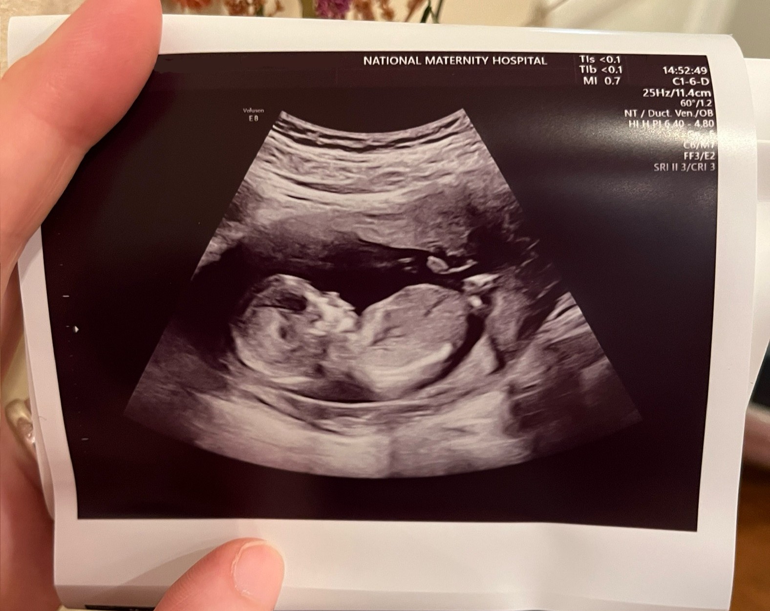 shared_motherhood_ultrasound_1.jpg