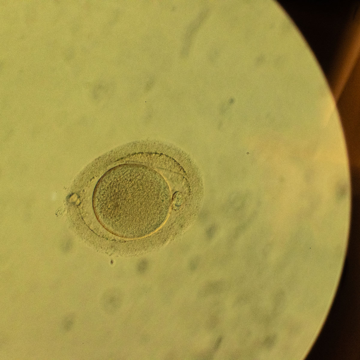 Mature-Egg.jpg